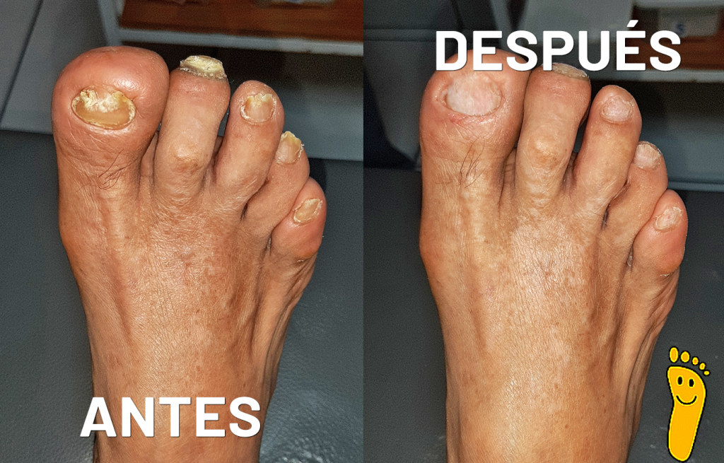 Gaciela Garcia Venegas_der_sup_