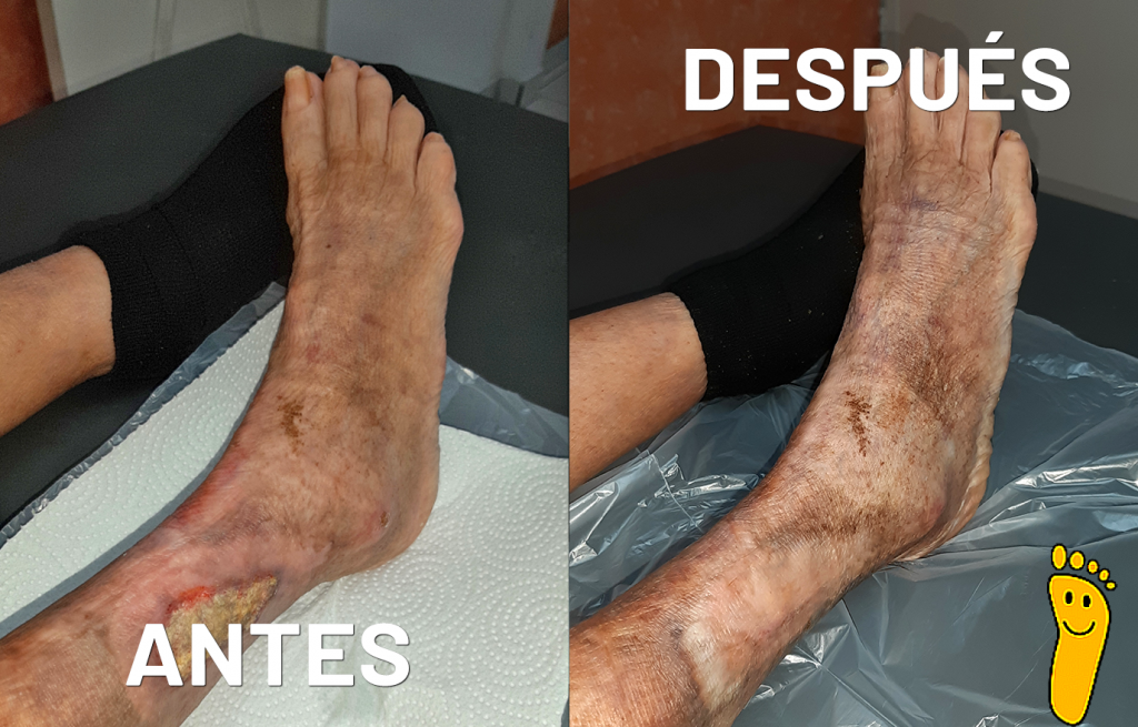 Lateral derecho 2