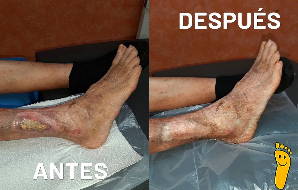 Lateral derecho