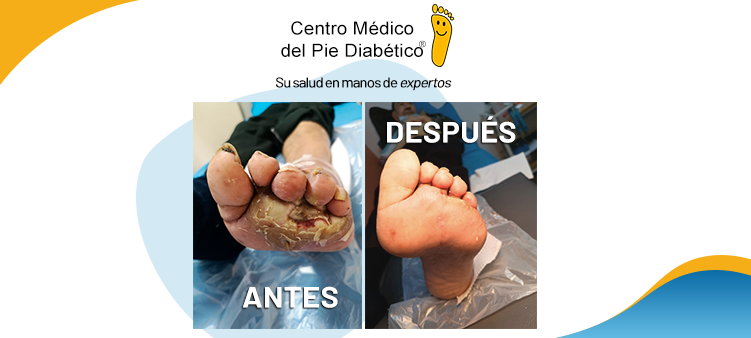 INFECCIONES